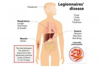 Local man, 82, critical with Legionnaires’ disease: SSM