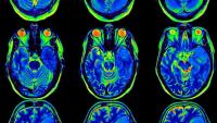 Scientists develop AI model designed to reconstruct images from brain activity