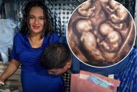 Colombian woman reaches 30 weeks pregnant with rare identical quadruplets