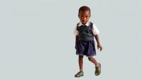 Corrective Surgery Restores Walking, Schooling and Dignity for Children in Rural Cameroon