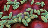 UKHSA says risk of plague 'very low' after Russian laboratory worker 'dies of suspected pneumonic plague'