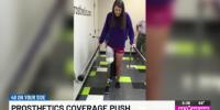 Alabama advocates push bill to require insurance coverage for activity-specific prosthetics