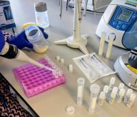 Scientists study breast milk as an early detection tool for breast cancer