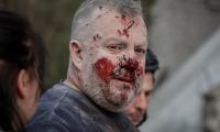 Russian guided bombs kill three in Kharkiv with one wounded factory worker left with a nail in his head
