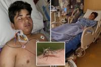 California boy, 13, left in grim condition after coming down with rare disease