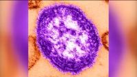 Measles cases surpass 1,000 in Pennsylvania amid the state's largest outbreak in decades