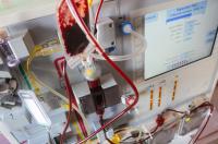 Can stem cell transplants be made safer? New clinical trial seeks to find out