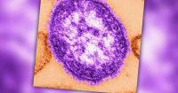 Pennsylvania surpasses 1K confirmed measles cases