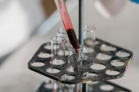 Scientists Say Younger Generations May Be 'Ageing Faster' as Early-Onset Cancer Rates Continue To Rise
