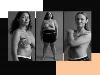 The Young Women Who Chose to Have Preventive Double Mastectomies