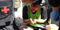 'Savagery': Horrific Injuries as French Police Crack Down on Nationwide Student Protests