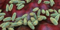 Questions raised about potential pneumonic plague outbreak after lab worker's death