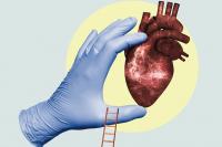 What to Know About Stroke Risk in Delaware