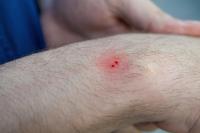 Texas elementary staffer is bitten by snake, with its species a mystery