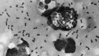 Brown University Health prepares following possible plague case in Russia