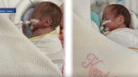 Parents plead to reunite twin baby girls being treated in NICUs at 2 separate hospitals