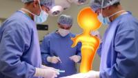 Surgeons Beat a Drug-Resistant Hip Infection With Staged Surgery and Antibiotics Delivered Straight Into the Joint
