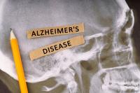 Alzheimer’s disease market expected to reach $14.7bn across the 8MM by 2033