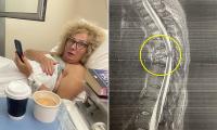 British mother who broke her back in Greece when car slammed into her quadbike is left with £28,000 medical bill due to 'wrong travel insurance'