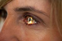 Swiss gene therapy for blindness makes further encouraging progress
