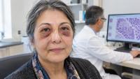 Raccoon Eyes with No Injury Were a 60-Year-Old Woman's Only Clue to a Rare Blood Protein Disease