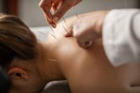 Tired of Chronic Pain? How Acupuncture May Actually Help