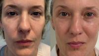 'Best' £25 balm called 'miracle worker' for mature skin loved by Kirsty Gallacher