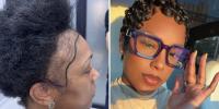I couldn't afford a $13,000 hair transplant in the US. So I flew to Turkey and I love the results.