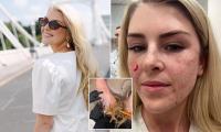 Biggest bridal beauty myths busted… and the painful cosmetic procedures to skip