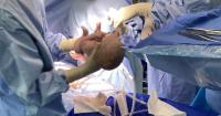 Championing women’s bodily autonomy in healthcare? Then lay off C-sections