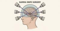 Gamma knife delivered to Kyrgyzstan for patient treatment