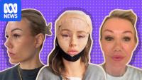 Plastic surgeons warn of complications as Australians seek face lifts overseas