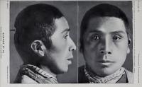 From vectors of disease to naturally resistant: How Bolivian medicine viewed Indigenous people