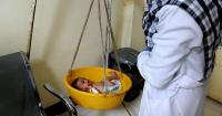 UN: Over 111,000 Children Hospitalised for Malnutrition in Afghanistan in One Month