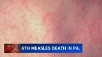 6th measles-related death reported in Pennsylvania, health officials say