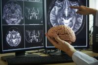 IU Scientists Create Compounds That Show Early Promise in Reducing Alzheimer's-Linked Brain Plaques 