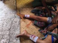 Three killed in Magway Region as Myanmar junta forces continue push into Rakhine 