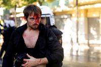 Riots erupt in Albania’s capital as students join anti-government movement