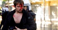 Riots erupt in Albania's capital as students join anti-government movement