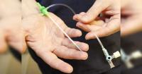 Health ministry asked to examine coronary stent safety concerns