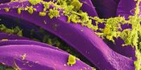 HOMETOWN HEALTH: What is pneumonic plague? UVA health expert discusses concerns after Siberia lab death