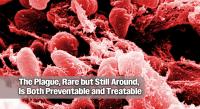 The Plague, Rare but Still Around, Is Both Preventable and Treatable