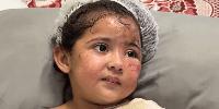 Israeli Strike Burns Gaza Mother Alive in Front of Toddler, 'Without Generating Any Headlines'