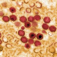 African Swine Fever: The Growing Threat to Livestock Production, Food Security, and Public Health -By Dr. Moris Umoru, DVM