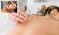 Woman details how horror acupuncture mishap sent her to the ER: 'New fear unlocked'