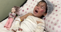 Israel Badly Burns Young Girl and Kills Her Mother in Airstrike on Gaza Home