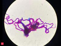In 2018, over 6,000 volunteers examined pictures of tuberculosis bacteria exposed to drugs; their answers helped researchers test resistance to 13 medicines