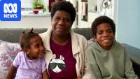 Siblings with feet turned backwards get life-changing care