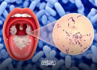 US Alerts Its Citizens Traveling to Morocco to a Small Diphtheria Outbreak