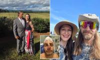 Georgia man left terribly disfigured by his two pet dogs says he doesn't blame them for attack and that he plans to keep them